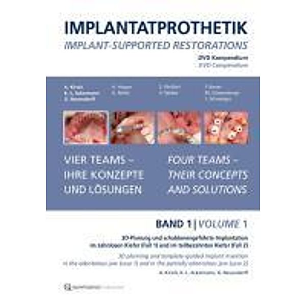 Ackermann, K: DVD-Kompendium Implantatprothetik 1, Karl-Ludwig Ackermann, Axel Kirsch, Gerhard Neuendorff