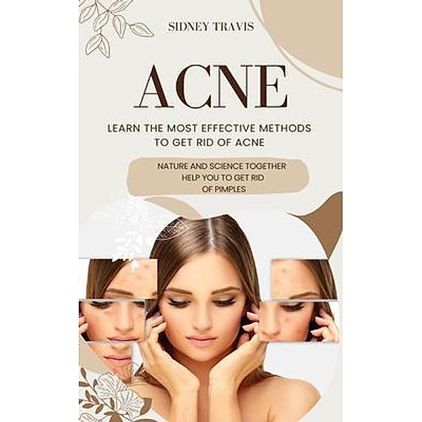 Acne, Sidney Travis