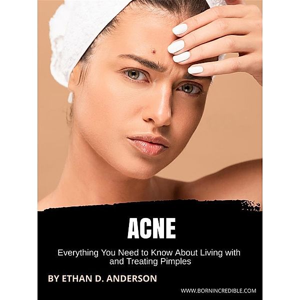 Acne, Ethan D. Anderson