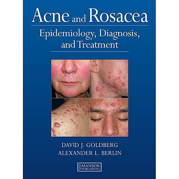 Acne and Rosacea, David Goldberg, Alexander Berlin