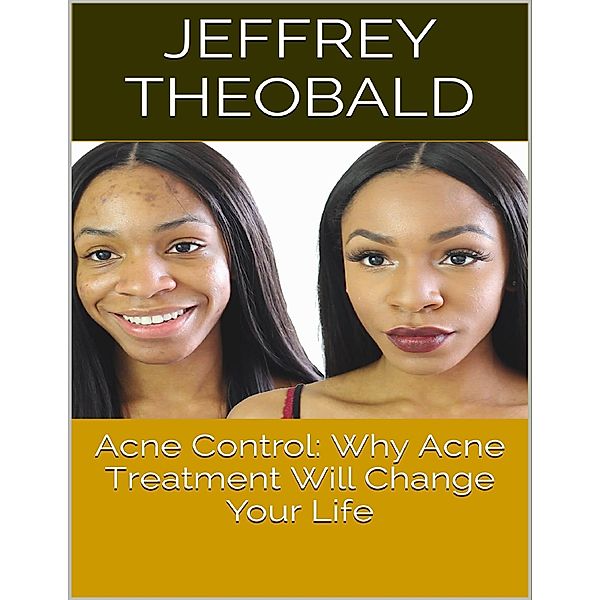 Acne Control: Why Acne Treatment Will Change Your Life, Jeffrey Theobald