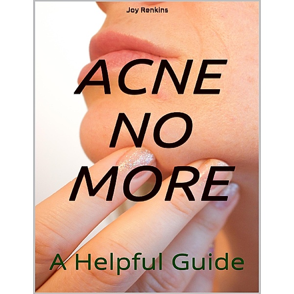 Acne No More;A Helpful Guide, Joy Renkins