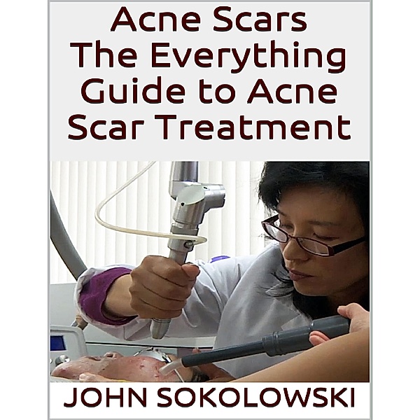 Acne Scars: The Everything Guide to Acne Scar Treatment, John Sokolowski