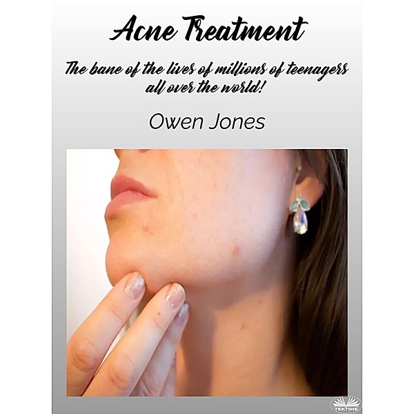 Acne Treatment, Owen Jones