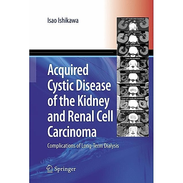 Acquired Cystic Disease of the Kidney and Renal Cell Carcinoma, Isao Ishikawa