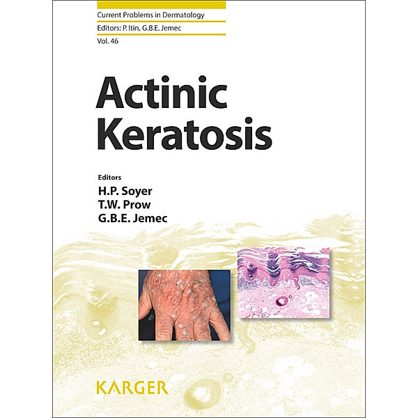 Actinic Keratosis