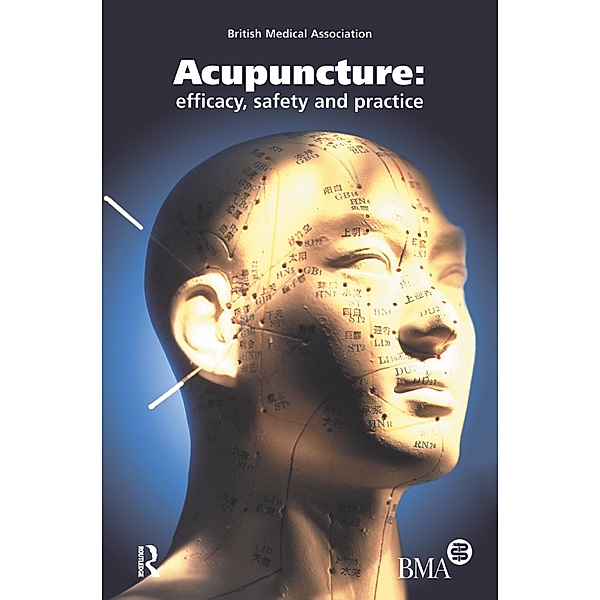 Acupuncture, British Medical Association