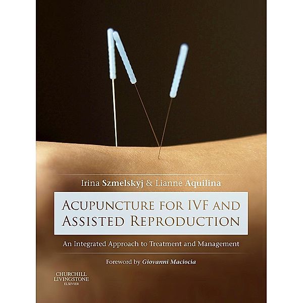 Acupuncture for IVF and Assisted Reproduction, Irina Szmelskyj, Lianne Aquilina