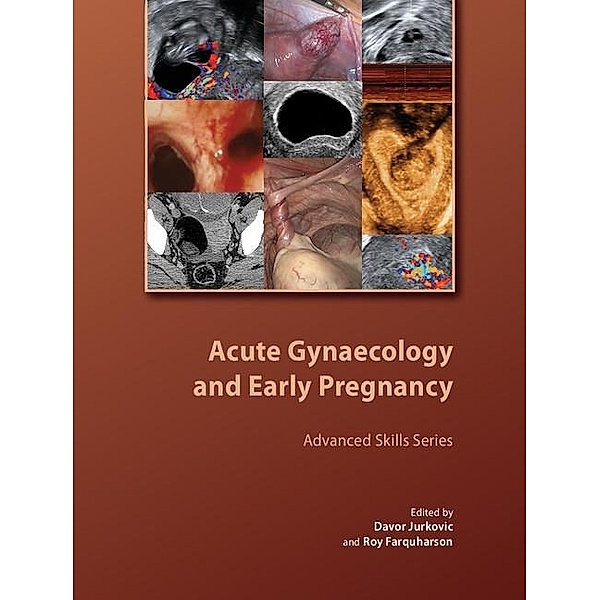 Acute Gynaecology and Early Pregnancy / Royal College of Obstetricians and Gynaecologists Advanced Skills