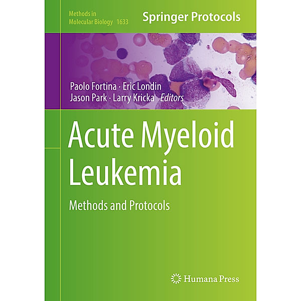 Acute Myeloid Leukemia