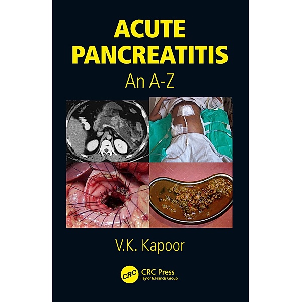 Acute Pancreatitis, V. K. Kapoor