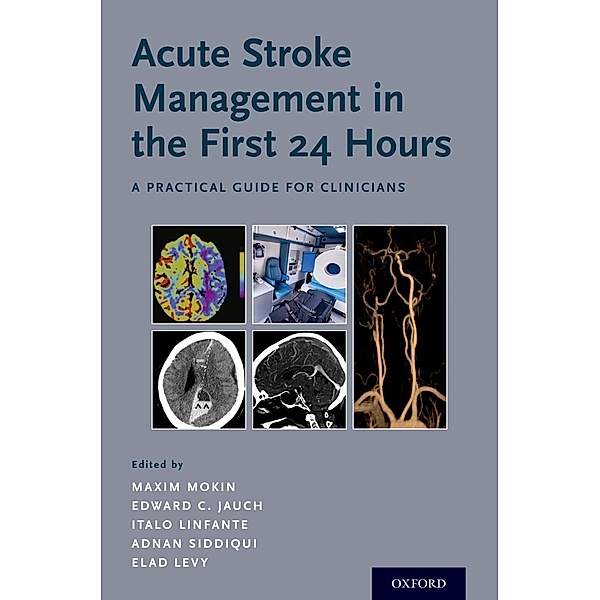 Acute Stroke Management in the First 24 Hours