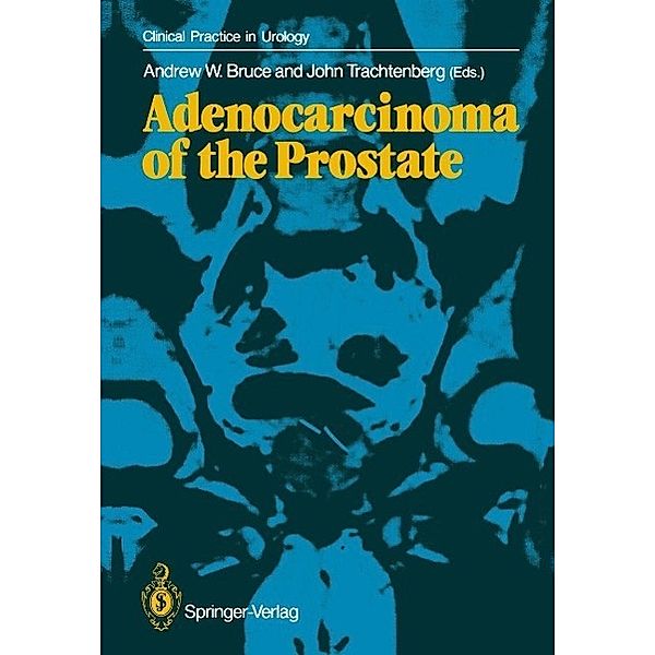 Adenocarcinoma of the Prostate / Clinical Practice in Urology