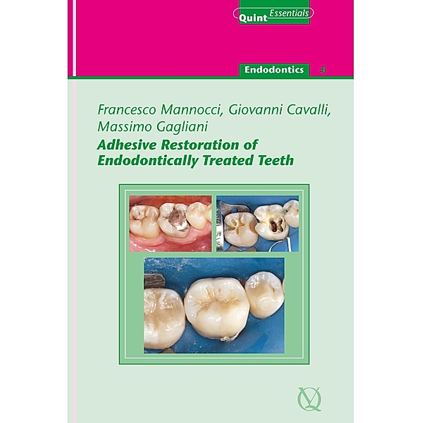 Adhesive Restoration of Endodontically Treated Teeth / QuintEssentials of Dental Practice Bd.40, Francesco Mannocci, Massimo Gagliani, Giovanni Cavalli