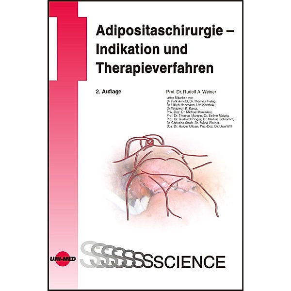Adipositaschirurgie - Indikation und Therapieverfahren / UNI-MED Science, Rudolf A. Weiner