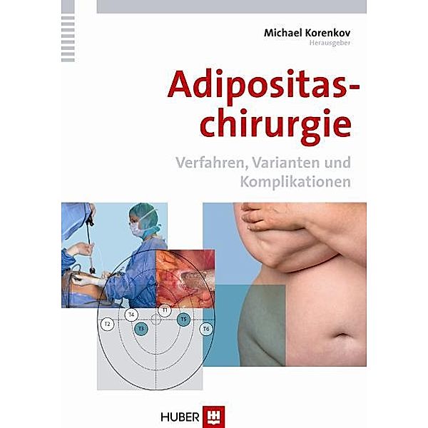 Adipositaschirurgie. Verfahren, Varianten und Komplikationen, Michael Korenkov