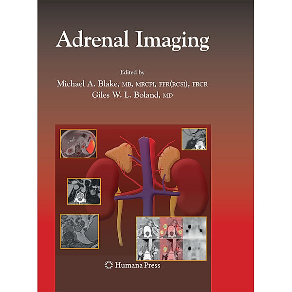 Adrenal Imaging