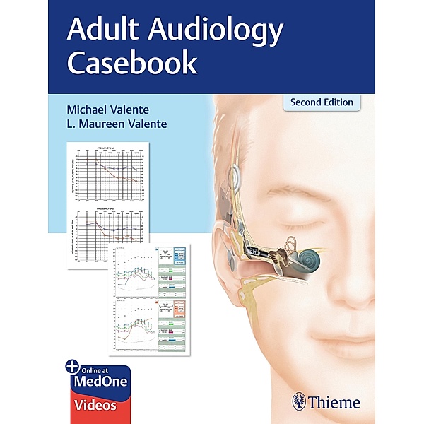 Adult Audiology Casebook, Michael Valente, L. Maureen Valente