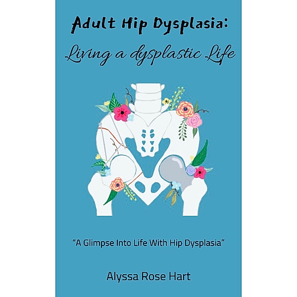 Adult hip Dysplasia: Living a Dysplasic Life, Alyssa Rose Hart