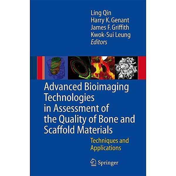 Advanced Bioimaging Technologies in Assessment of the Quality of Bone and Scaffold Materials