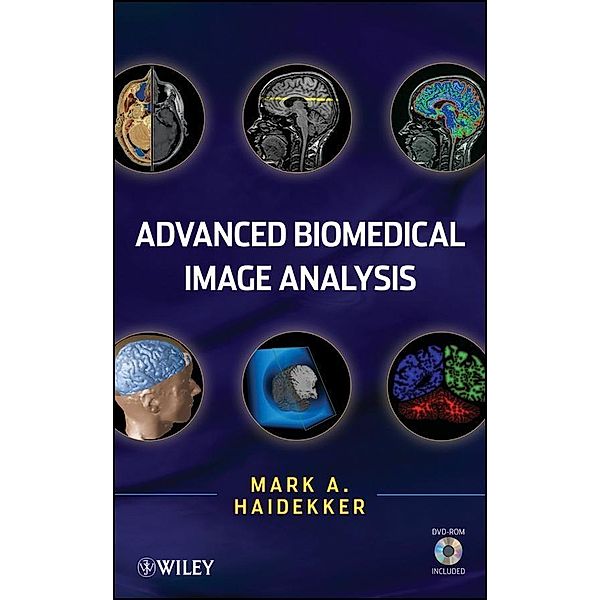 Advanced Biomedical Image Analysis, Mark Haidekker