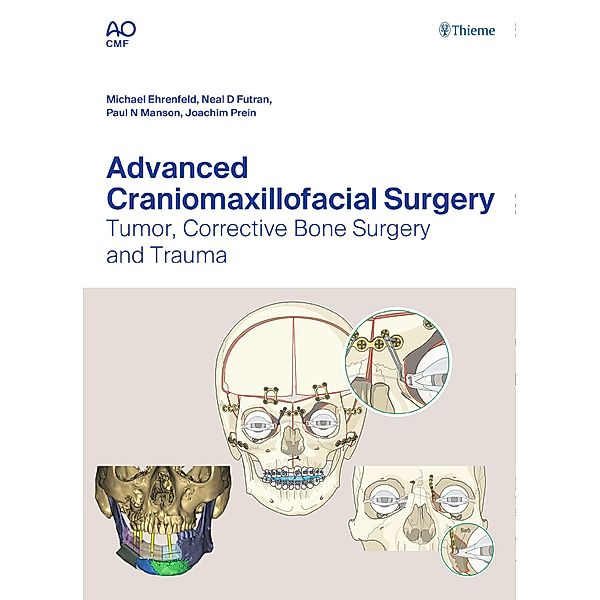 Advanced Craniomaxillofacial Surgery