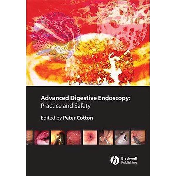 Advanced Digestive Endoscopy