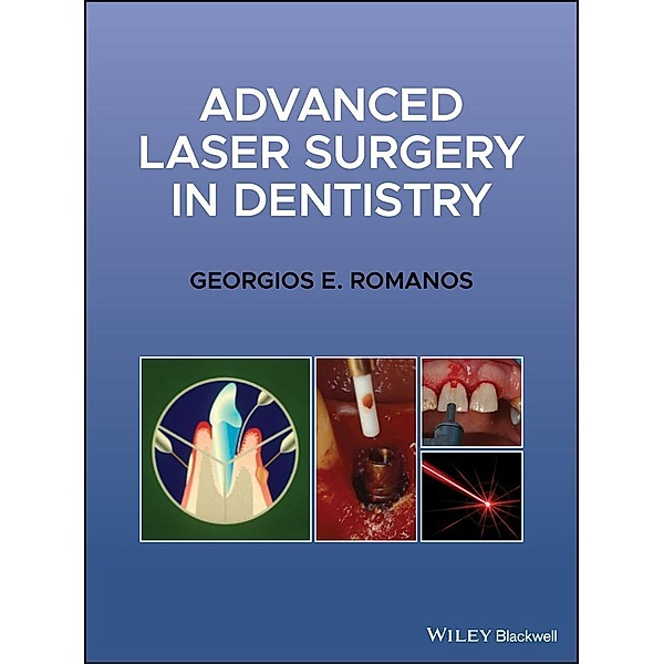 Advanced Laser Surgery in Dentistry, Georgios E. Romanos