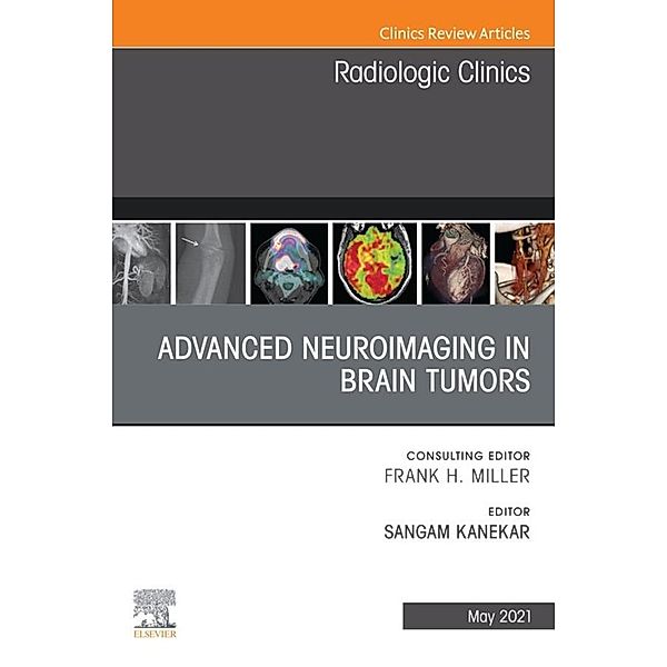 Advanced Neuroimaging in Brain Tumors, An Issue of Radiologic Clinics of North America, E-Book