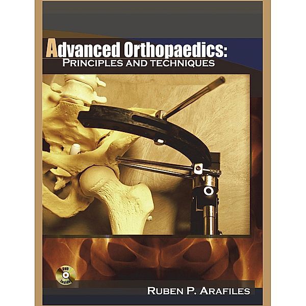 Advanced Orthopaedics, Md Ruben P. Arafiles