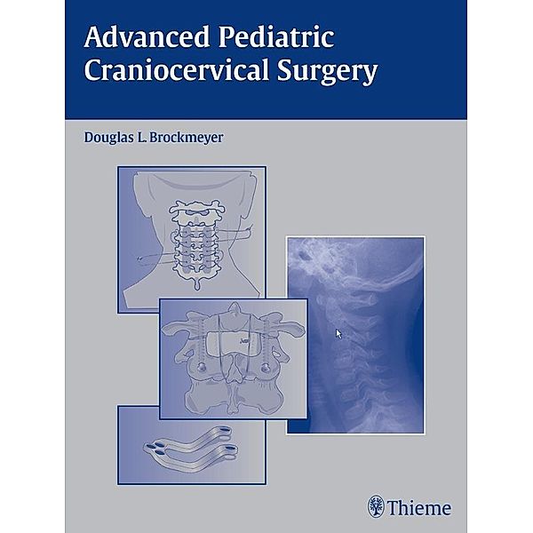 Advanced Pediatric Craniocervical Surgery