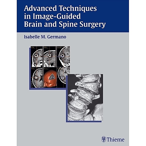 Advanced Techniques in Image-Guided Brain and Spine Surgery, Isabelle M. Germano