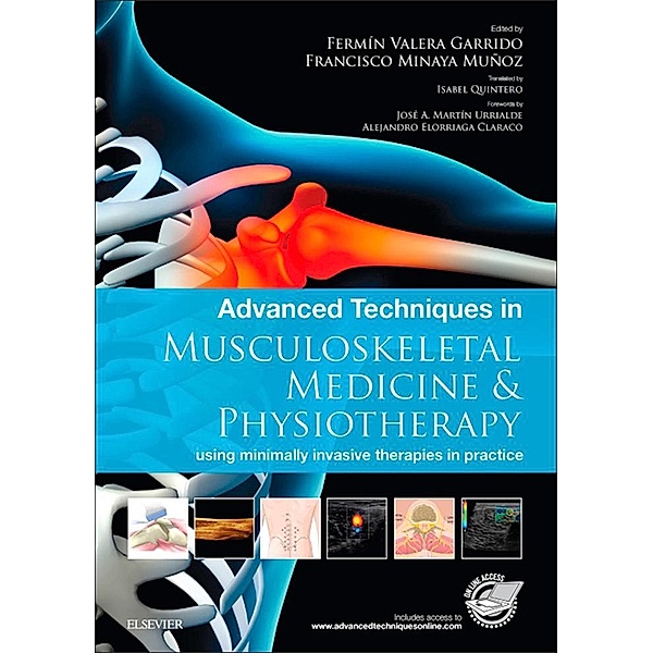 Advanced Techniques in Musculoskeletal Medicine & Physiotherapy - E-Book, Fermín Valera Garrido, Francisco Minaya Muñoz