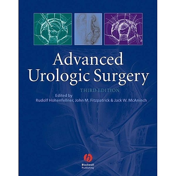 Advanced Urologic Surgery