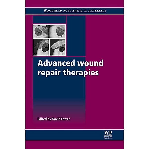 Advanced Wound Repair Therapies