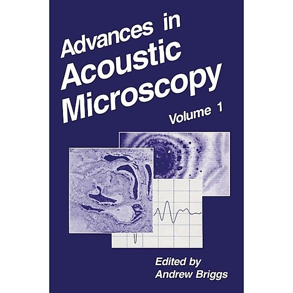 Advances in Acoustic Microscopy / Advances in Acoustic Microscopy Bd.1