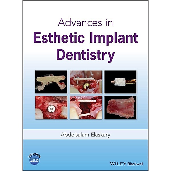 Advances in Esthetic Implant Dentistry, Abdelsalam Elaskary