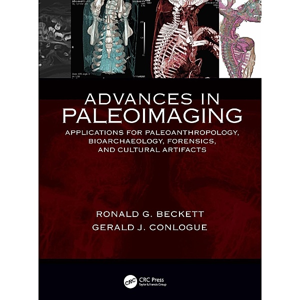 Advances in Paleoimaging, Gerald J. Conlogue, Ronald G. Beckett