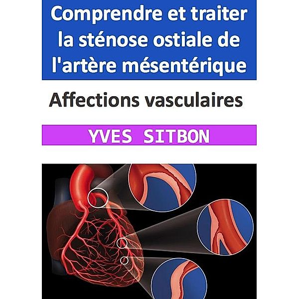 Affections vasculaires : Comprendre et traiter la sténose ostiale de l'artère mésentérique, Yves Sitbon