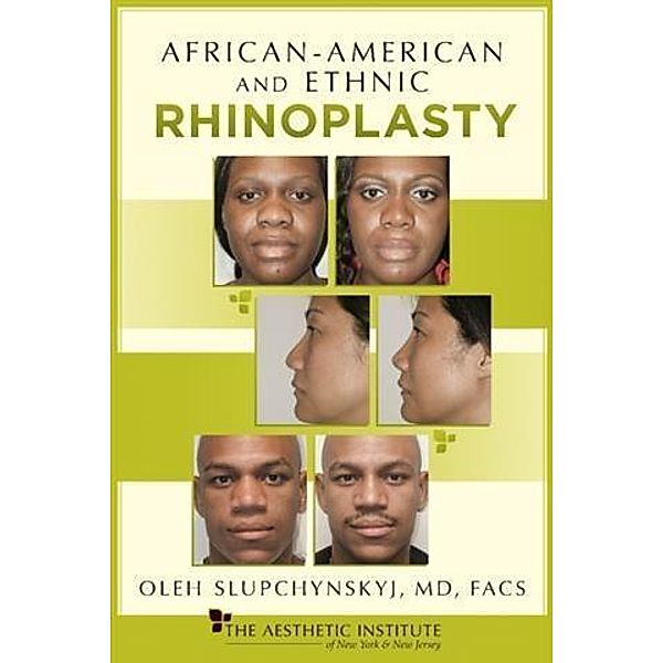 African-American and Ethnic Rhinoplasty, MD, FACS Oleh Slupchynskyj