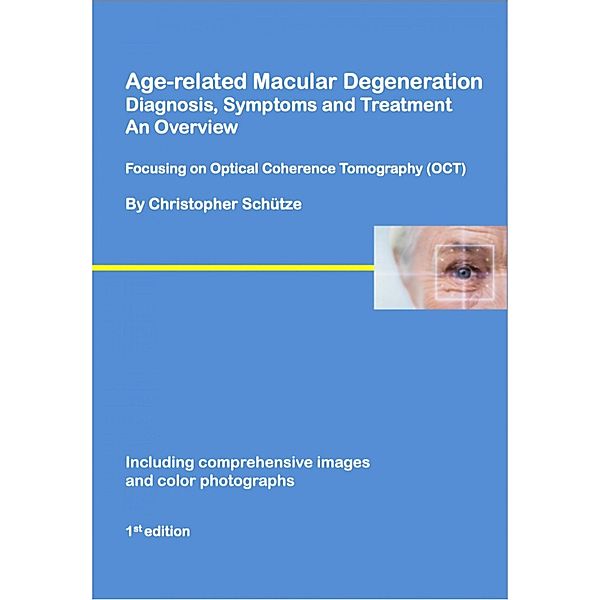 Age-related macular degeneration, Christopher Schütze