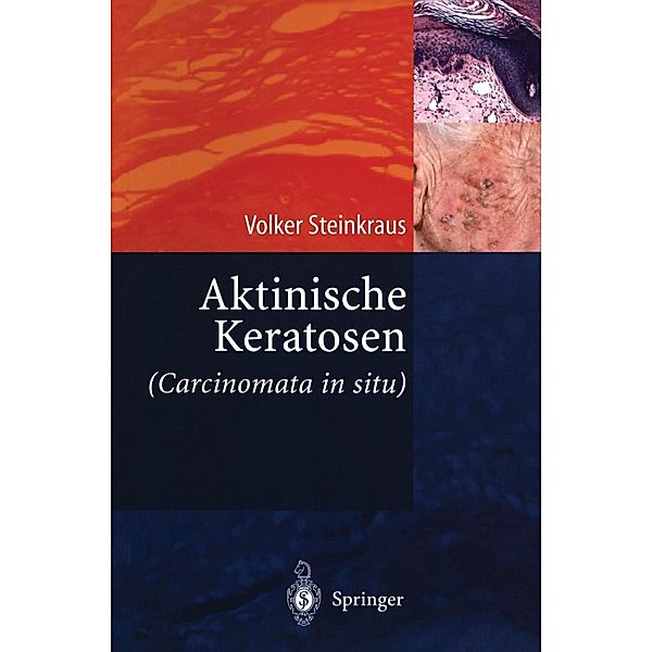 Aktinische Keratosen (Carcinomata in situ), Volker Steinkraus