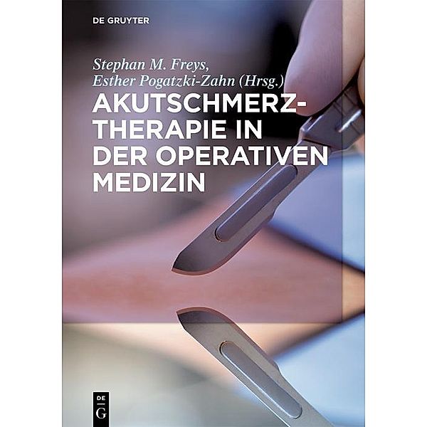 Akutschmerztherapie in der Operativen Medizin