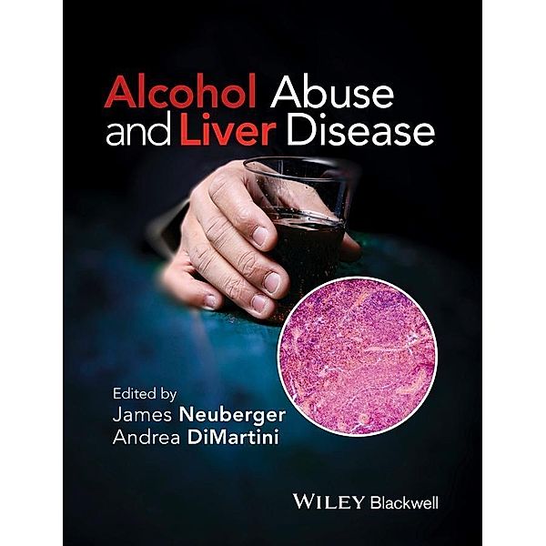 Alcohol Abuse and Liver Disease, Andrea Dimartini