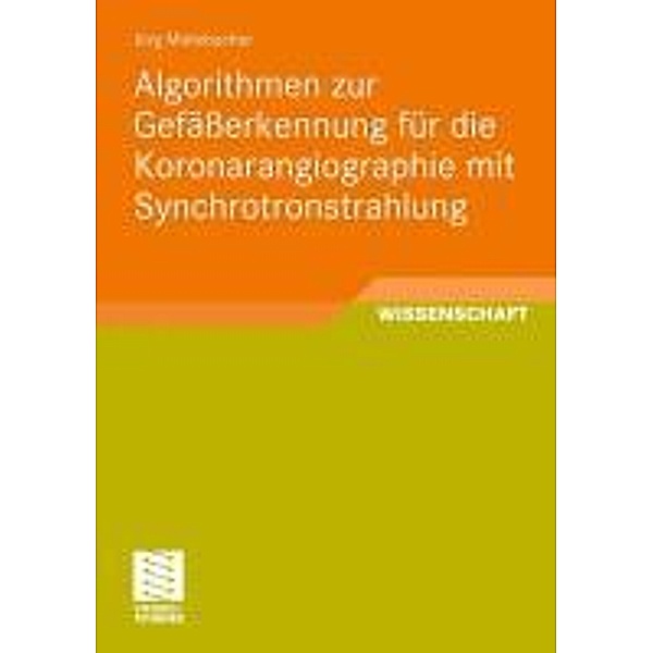 Algorithmen zur Gefäßerkennung für die Koronarangiographie mit Synchrotronstrahlung, Jörg Mielebacher