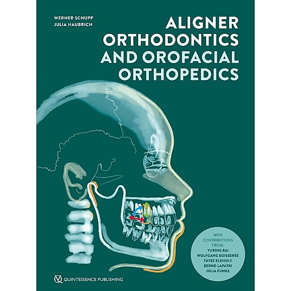 Aligner Orthodontics and Orofacial Orthopedics, Werner Schupp, Julia Haubrich