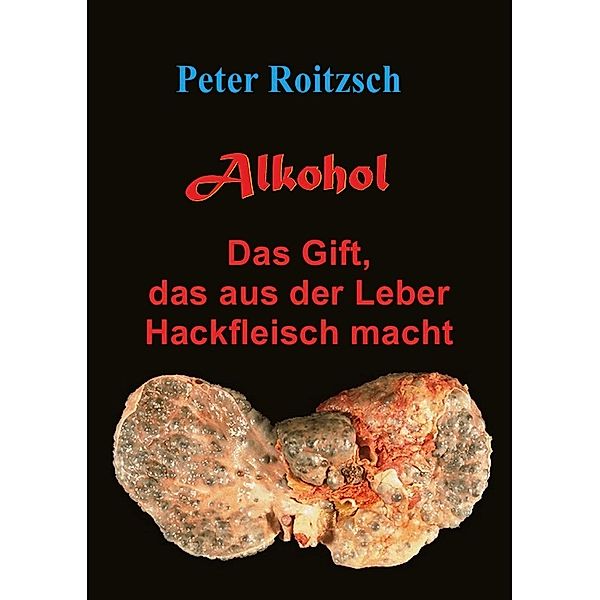 Alkohol - Das Gift, das aus der Leber Hackfleisch macht, Peter Roitzsch
