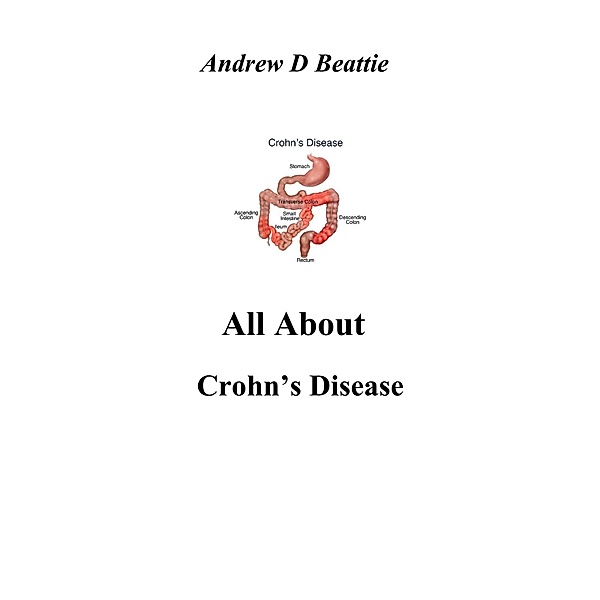All About Crohn's Disease / All About, Andrew D Beattie