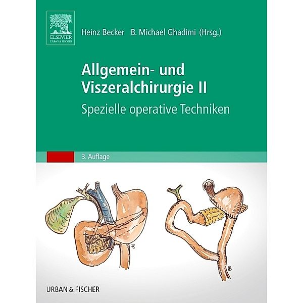 Allgemein- und Viszeralchirurgie.Bd.2
