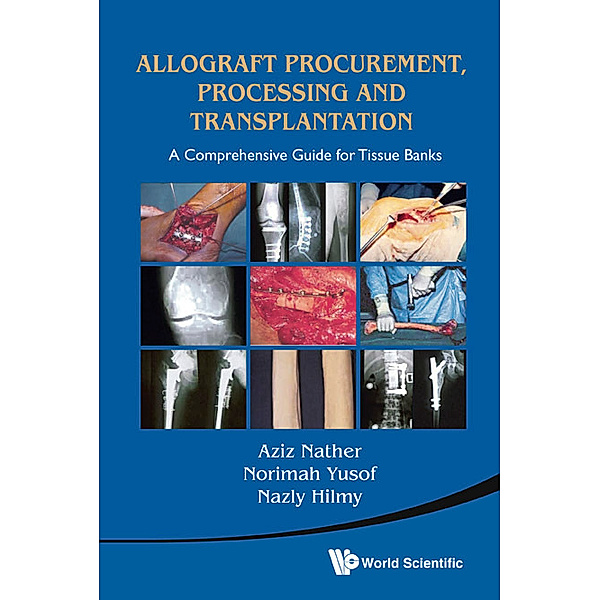 Allograft Procurement, Processing and Transplantation, Aziz Nather, Norimah Yusof;Nazly Hilmy;;